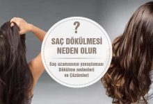Saç Dökülmesi Neden Olur? 12 Sebep ve Çözüm!